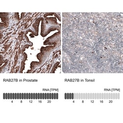 RAB27B Antibody, Novus Biologicals:Antibodies:Primary Antibodies